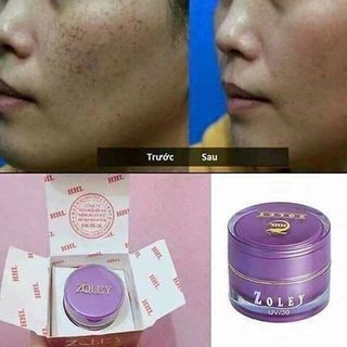kem Zoley ngừa nám tàn nhanhchốn nhăng da