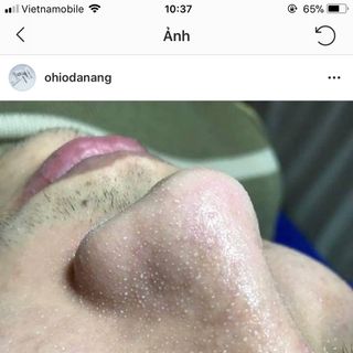 SALE LỖ VỐN 280k SALE 60k