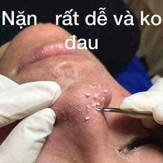 SALE LỖ VỐN 280k SALE 60k