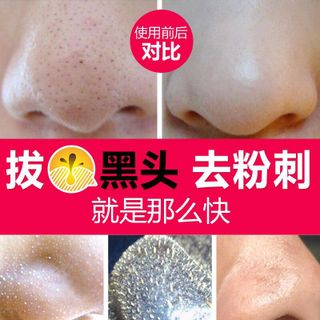Mặt nạ lột mụn 3 set lớn bioaqua