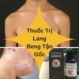 Thuốc Trị Lang Beng Nam Hoàng