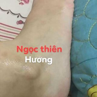 Trị thâm NGỌC THIÊN HƯƠNG