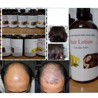 Lotion tinh dầu bưởi giảm rụng tóc dài và dày tóc giá sỉ