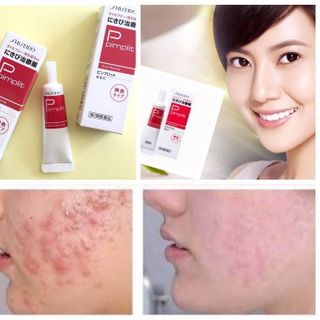 Kem trị mụn Pimplit 15g