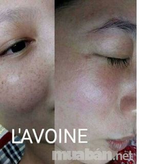 Kem trị nám Melasma Night Cream