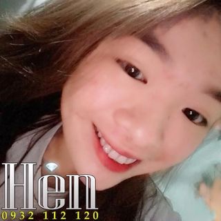 Đá đính răng 27 ly - Xuất xứ Úc