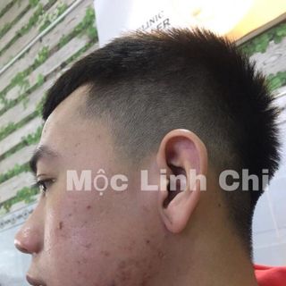 Mộc linh chi chuyên trị mụn- nám- tàn nhang