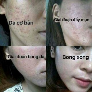 thảo dược thuốc bắc tái tạo da