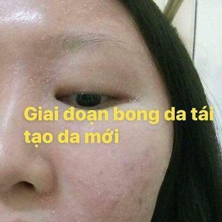 mộc linh chi trị mụn nám tàn nhang