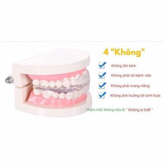 bộ niềng răng tại nhà