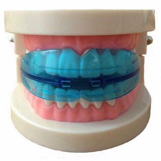 bộ niềng răng tại nhà