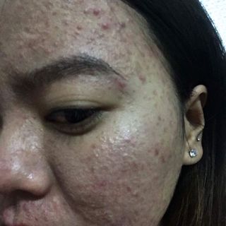Mặt nạ dưỡng trắng da thuốc bắc an an