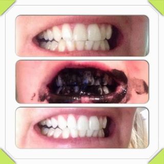 Trắng răng Bột Than Hoạt Tính Teeth Whitening