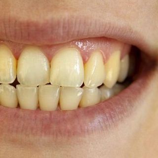 Trắng răng Bột Than Hoạt Tính Teeth Whitening