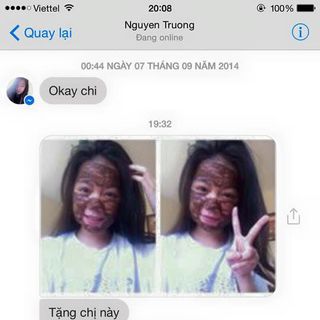 Mặt nạ trị mụn thuốc bắc an an