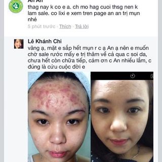 gel trị thâm