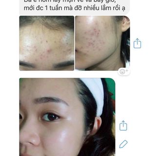 gel trị thâm