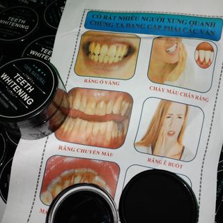 TRẮNG RĂNG TEETH WHITENING NHẬT BẢN THIÊN NHIÊN