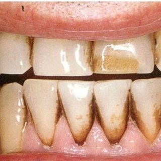Bột trắng răng Teeth Whitening Nhật Bản