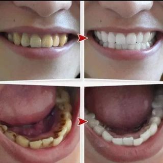 Bột trắng răng Teeth Whitening Nhật Bản