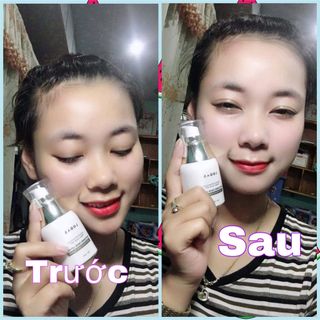 FACE LODAS TINH CHẤT NGẬM TRẮNG