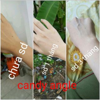 Candy Angel k trắng k lấy tiền