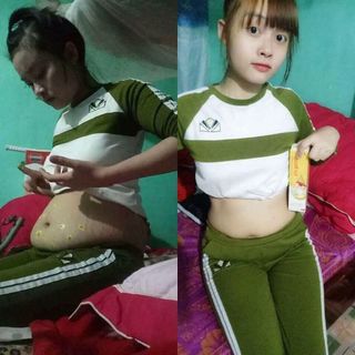 KEM MASSAGE TAN MỠ