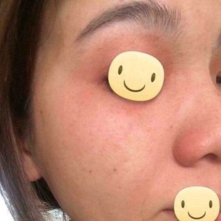 THUỐC BẮC TÁI TẠO DA