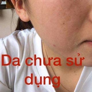 THUỐC BẮC TÁI TẠO DA