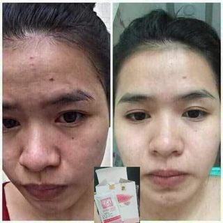 Cốm Đẹp Da cốm skin food