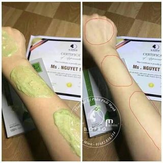 TẮM TRẮNG TẢO BIỂN