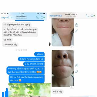MASK DETOX THẢI ĐỘC NGỪA MỤN NEWSKIN