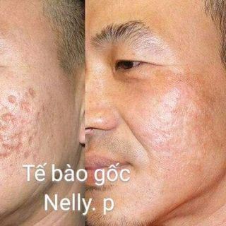 Tế bào gốc BIOEGF giá sỉ