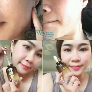 mỹ phẩm hàn quốc Wynn