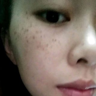 Cỏ Trị Nám Sắc mộc Lam