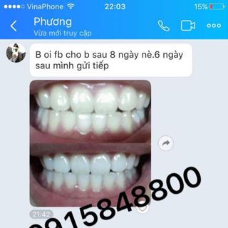 Đặc trị răng miệng từ thảo dược an toàn