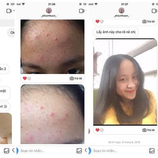 20dayskin