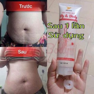 gel tan mỡ vybody