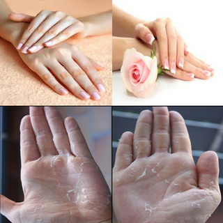 Kem Trị Khô Nẻ Da Tay Barkhaty