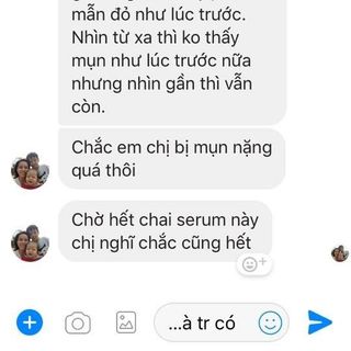 serum trị mụn
