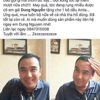 Bộ AMLA Đặc Trị Rụng Tóc Dưỡng tóc Mềm Mượt Kích Mọc Tóc Hiệu Quả