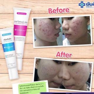 Kem trị mụn - YANHEE ACNE CREAM - 10gram
