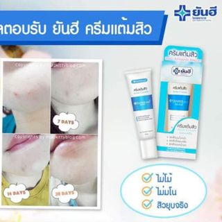 Kem Trị Mụn - YANHEE ACNE CREAM - 5gram