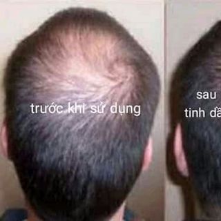 Dầu gội và Tinh dầu dưỡng Hương Bưởi