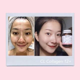 CL colagen 12 Mới Trị Mụn ThâmSẹo Nám Trắng da gấp 2 lần