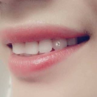Đá đỉnh răng