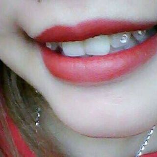 Đá đỉnh răng