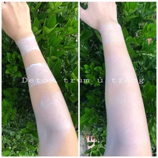Detox trùm ủ trắng thải độc da