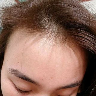 Dầu Gội Ngăn rụng và kích mọc tóc con