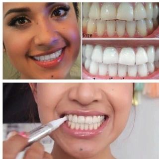 BÚT TẨY TRẮNG RĂNG DAZZLING WHITE